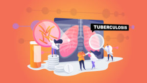 Read more about the article Answering common questions and doubts about Tuberculosis